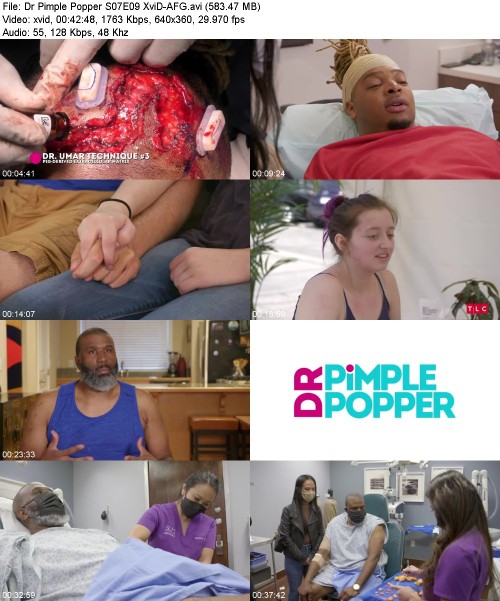 Dr Pimple Popper S07E09 XviD-[AFG]