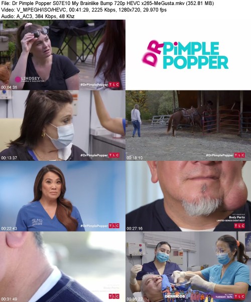 Dr Pimple Popper S07E10 My Brainlike Bump 720p HEVC x265-[MeGusta]
