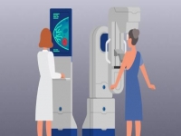 Як зробити мамографію безоплатно?Пояснення НСЗУ