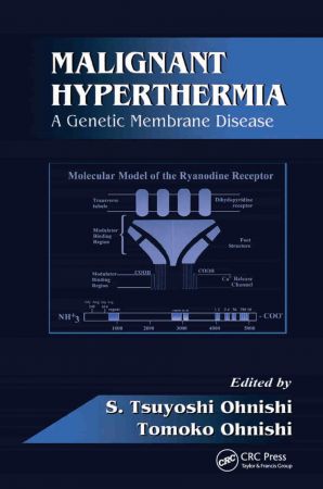 Malignant Hyperthermia A Genetic Membrane Disease