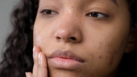 Udemy - Spa Treatments for Oily Skin